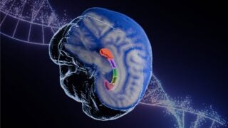 Corpus callosum
